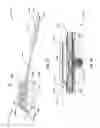 Fig. 14 - Implantable medical device structures