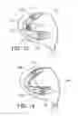 Fig. 07 - Golf club head having movable weights