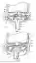 Fig. 02 - PIPETTE HAVING INTEGRATED FILTRATION ASSEMBLY