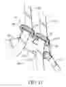 Fig. 22 - Multi-point seat belt assembly