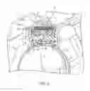 Fig. 03 - DE-LASH ASSEMBLY FOR MANUALLY ADJUSTABLE STEERING COLUMN