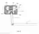 Fig. 02 - Steering gear for a vehicle, vehicle, method for controlling a steering gear and method for steering a vehicle
