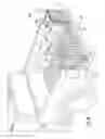 Fig. 19 - Mega elongator