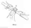 Fig. 03 - Height adjustable seatpost assembly