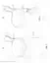 Fig. 02 - INTEGRATED UTENSIL AND LID APPARATUS