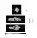 Fig. 08 - Compound for specifically binding to amyloid β-protein