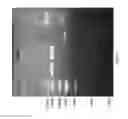 Fig. 06 - Method for establishing eukaryotic expression cell line of CD36 mutant gene that encodes CD36 deficiency
