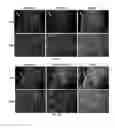 Fig. 09 - Composition and Method for Therapeutic Agent Delivery During Pregnancy