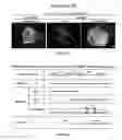 Fig. 03 - TM4SF1 binding proteins and methods of using same