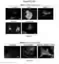 Fig. 04 - TM4SF1 binding proteins and methods of using same