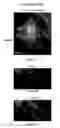 Fig. 06 - TM4SF1 binding proteins and methods of using same