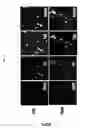 Fig. 09 - Method for direct transdifferentiation reprogramming into neurons using electromagnetic-induced metal nanoparticles
