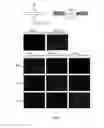 Fig. 02 - Read Through Of Truncated Proteins In Premature Termination Codon Diseases Using An Optimized Genetic Codon Expansion System