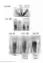 Fig. 06 - METHODS OF ATTACHING PROBES TO MICROORGANISMS AND METHODS OF USE THEREOF