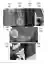 Fig. 09 - METHODS OF ATTACHING PROBES TO MICROORGANISMS AND METHODS OF USE THEREOF