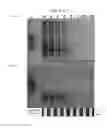 Fig. 06 - Detection device having capture region and detection region