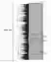 Fig. 02 - METHODS OF PROGNOSING, DIAGNOSING AND TREATING IDIOPATHIC PULMONARY FIBROSIS
