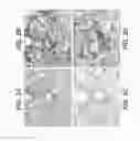 Fig. 07 - METHODS OF PROGNOSING, DIAGNOSING AND TREATING IDIOPATHIC PULMONARY FIBROSIS