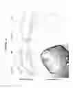 Fig. 15 - Screening method