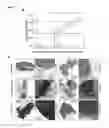Fig. 02 - Means and methods for staging, typing and treating a cancerous disease