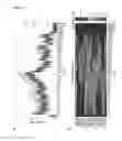 Fig. 11 - Means and methods for staging, typing and treating a cancerous disease
