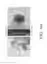 Fig. 41 - COMPOSITIONS AND METHODS FOR SCREENING PEDIATRIC GLIOMAS AND METHODS OF TREATMENT THEREOF
