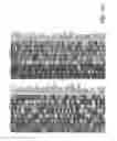 Fig. 53 - COMPOSITIONS AND METHODS FOR SCREENING PEDIATRIC GLIOMAS AND METHODS OF TREATMENT THEREOF