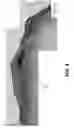 Fig. 06 - Heterogeneously stacked multi layered metallic structures with adiabatic shear localization under uniaxial dynamic compression
