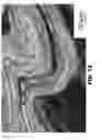 Fig. 09 - Heterogeneously stacked multi layered metallic structures with adiabatic shear localization under uniaxial dynamic compression