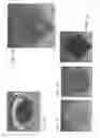 Fig. 02 - Systems and methods for imaging and processing tissue