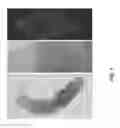 Fig. 02 - METHODS TO DETECT NON-GENOTOXIC CARCINOGENS USING FLATWORMS