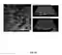 Fig. 32 - MACRO TISSUE EXPLANT, METHODS AND USES THEREFOR