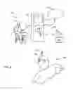 Fig. 08 - AUGMENTED REALITY INTERFACE FOR MEDICAL DEVICE