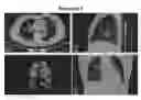 Fig. 01 - System and method for image segmentation