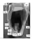 Fig. 01 - Gait feedback system