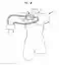 Fig. 02 - Vessel cutdown simulant