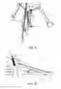 Fig. 09 - Instrument pedal device