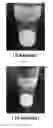 Fig. 04 - METHOD FOR PREPARING SOLID ELECTROLYTES USING SONOCHEMICAL PROCESS