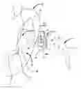 Fig. 01 - Reconfigurable intra-auricular support