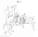 Fig. 03 - Reconfigurable intra-auricular support