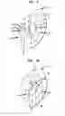 Fig. 07 - Reconfigurable intra-auricular support