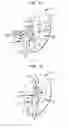 Fig. 08 - Reconfigurable intra-auricular support