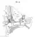 Fig. 09 - Reconfigurable intra-auricular support