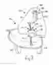 Fig. 03 - Attachment plate for supporting walk behind trimmers with third wheel