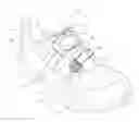 Fig. 01 - Reel based lacing system