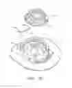 Fig. 19 - Reel based lacing system