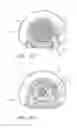 Fig. 30 - Reel based lacing system