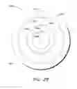 Fig. 30 - Hand-held device for electrical impedance myography