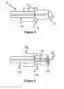 Fig. 04 - Air Line Protection Coupling For A Catheter