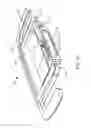 Fig. 02 - COMPACT LIGHT SENSORS FOR SURGICAL APPLICATIONS AND SHOCK DETECTION